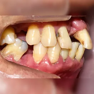 Before