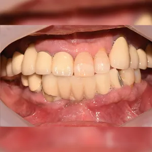 Before