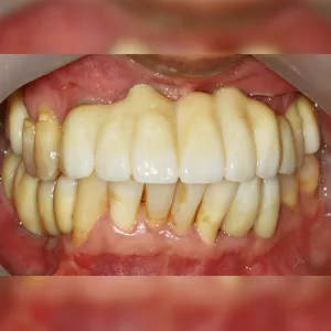 After