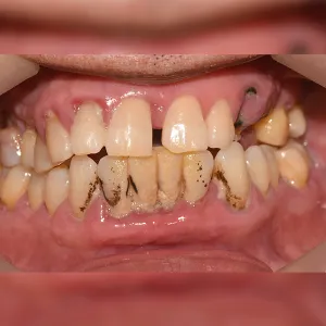 Before