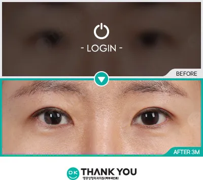 Before & After
