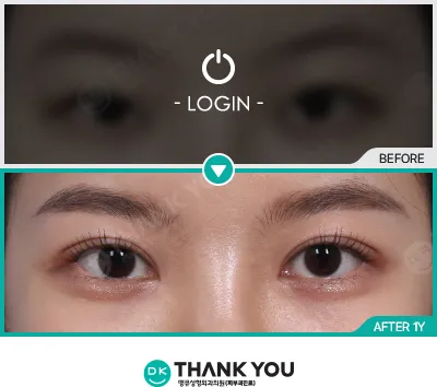 Before & After