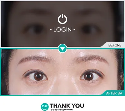 Before & After