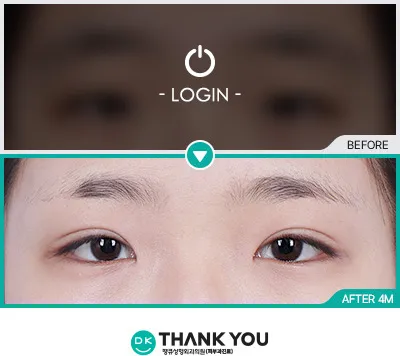 Before & After
