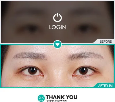 Before & After