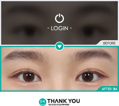 Before & After