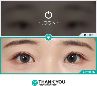 Before & After
