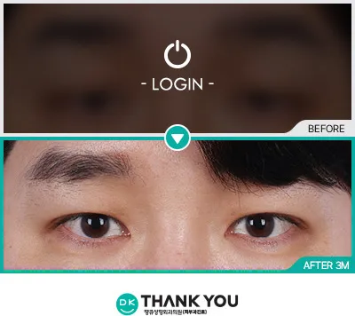 Before & After