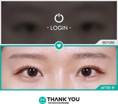 Before & After