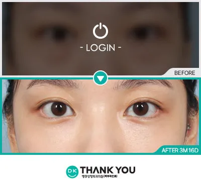Before & After