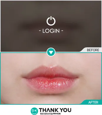 Before & After