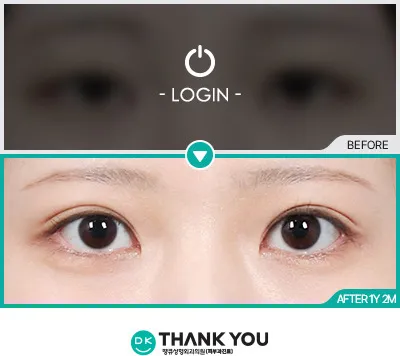 Before & After