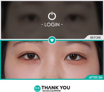 Before & After