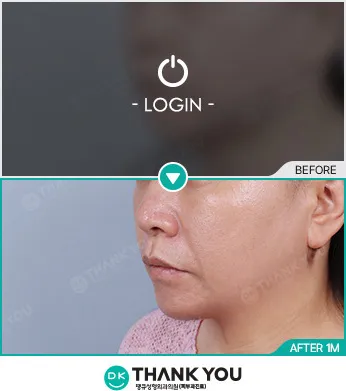 Before & After