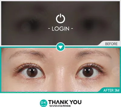 Before & After