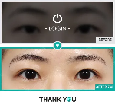 Before & After