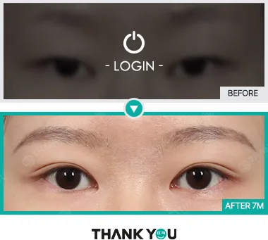 Before & After