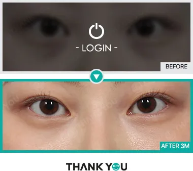 Before & After