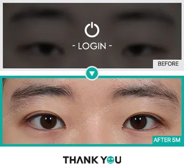Before & After