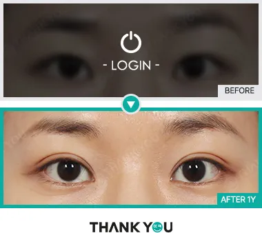 Before & After