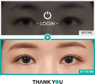 Before & After
