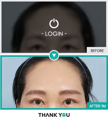 Before & After