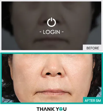 Before & After