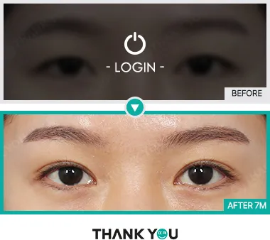 Before & After