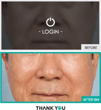 Before & After