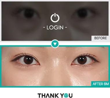 Before & After
