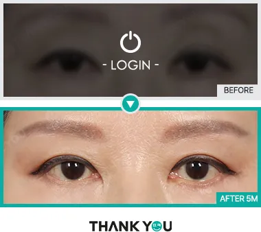 Before & After