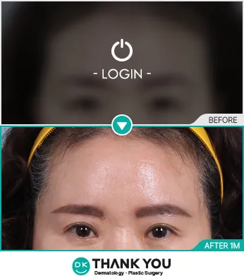 Before & After