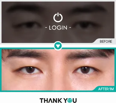 Before & After
