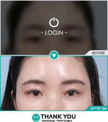Before & After