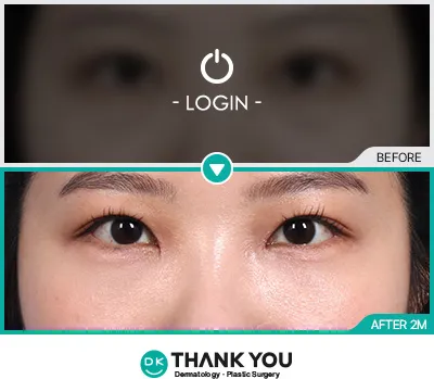 Before & After