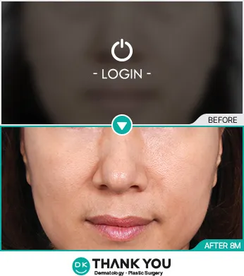 Before & After