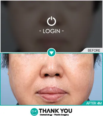 Before & After