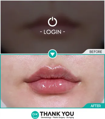 Before & After