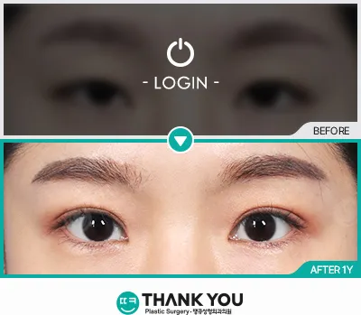 Before & After