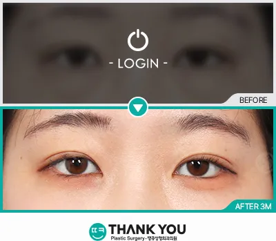 Before & After