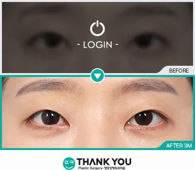 Before & After