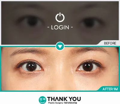 Before & After
