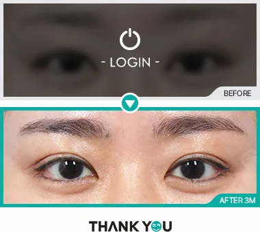 Before & After