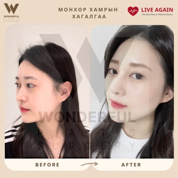 Wonderful гоо сайхны мэс заслын эмнэлэг   Before & After 