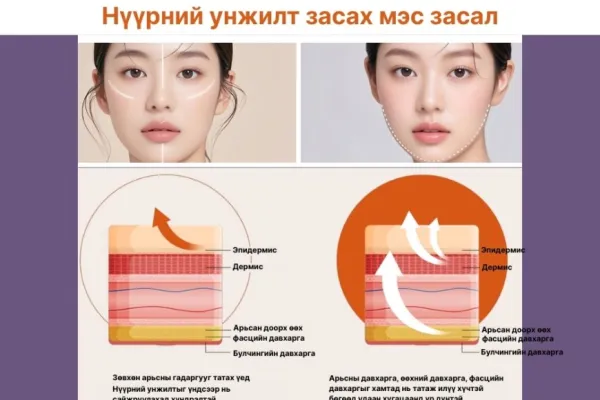 🧠 Нүүрний унжилт – Яагаад зөвхөн арьсыг татах нь хангалтгүй вэ?