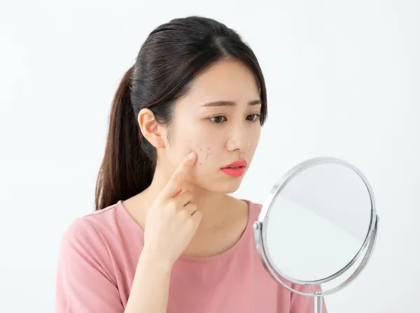 Điều trị sẹo mụn bằng laser có hiệu quả thật không?! Giải thích chi tiết các phương pháp điều trị được khuyên dùng theo từng loại