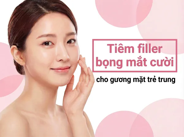 Filler bọng mắt dưới: Giải thích chi tiết về cơn đau và thời gian duy trì