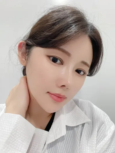 Mình đã phẫu thuật lại mũi thành công tại Thẩm mỹ viện Want!