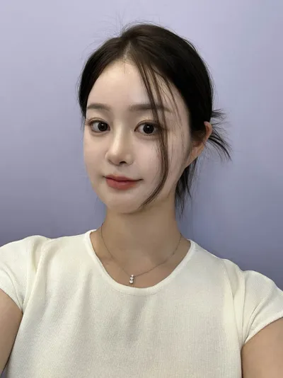 Mình đã phẫu thuật gọt mặt và tái phẫu thuật mũi♥