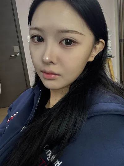 Phẫu thuật lại mũi xong làm mình thấy thích chụp ảnh tự sướng ghê :)